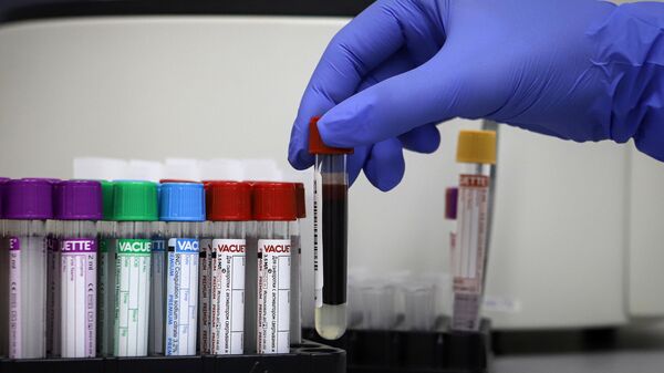 Пробирки с биоматериалом для выполнения теста на наличие антител к коронавирусу